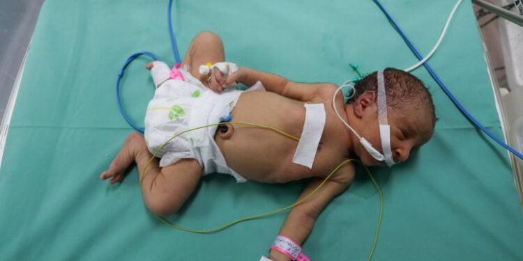 Mothers, Small babies, Sickly newborns, Stillbirths, Gaza, UN