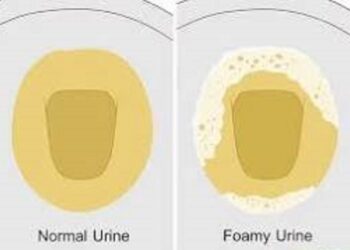 Foamy urine, Causes