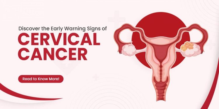 CERVICAL CANCER, Access, Save Lives, FIND