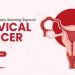 CERVICAL CANCER, Access, Save Lives, FIND