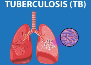 GLOBAL TUBERCULOSIS FIGHT, Prevention, Eradication, St. George’s University